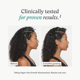 Women's Balance Hair Growth Supplements, Ages 45 and Up, Clinically Proven for Visibly Thicker Hair and Scalp Coverage, Dermatologist Recommended - 1 Month Supply