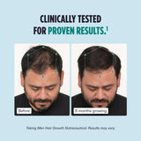 Men's Hair Growth Supplements, Clinically Tested for Visibly Thicker Hair and Scalp Coverage, Dermatologist Recommended - 1 Month Supply
